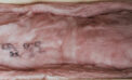 Installing insulation can be hazardous to your health Installing insulation can be hazardous to your health